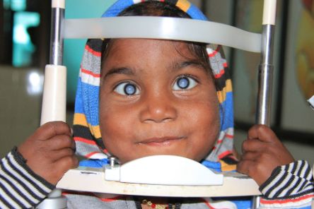 Die dreijährige Kushi aus Indien wird an den Augen untersucht. Sie hatte angeborenen bilateralen Grauen Star, es drohte Kindernlindheit. Nach einer erfolgreichen Grauer Star-OP kann sie wieder sehen.